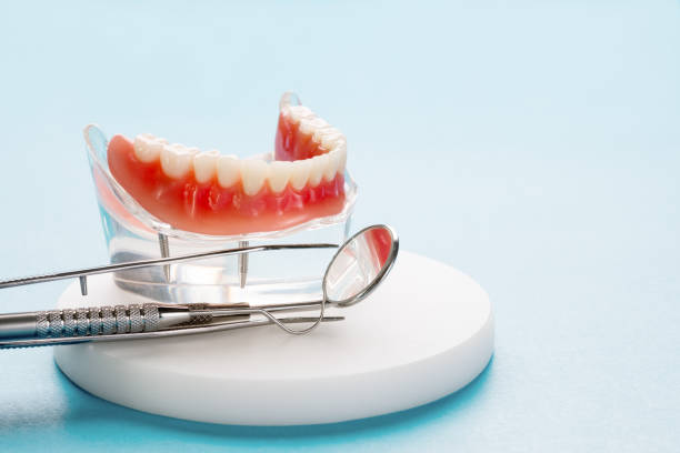 Dental Inlays and Onlays in Kenton, OH